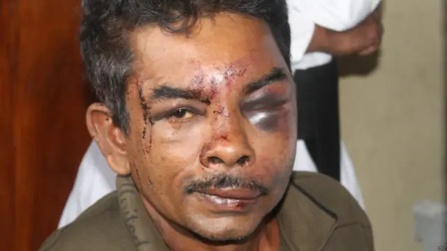 ප්රහාරයෙන් බරපතල තුවාල ලැබූවෙක්