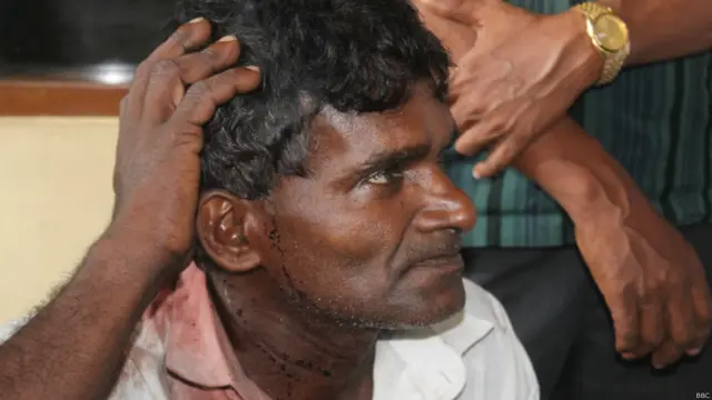 ප්රහාරයෙන් තුවාල ලැබූ තවත් පුද්ගලයෙක්