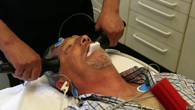 Hombre en sesión de terapia electroconvulsiva 