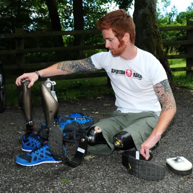 लांस बॉम्बार्डियर जेम्स सिम्प्सन, DOUBLE AMPUTEE Lance Bombardier James Simpson