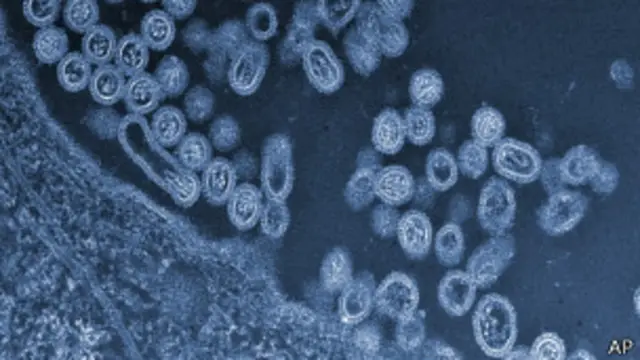 Virus