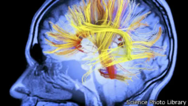 Человеческий мозг