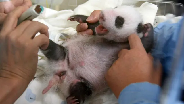 圆仔身体检查（AFP/TAIPEI ZOO）