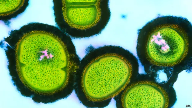 Staphylococcus aureus bacteria