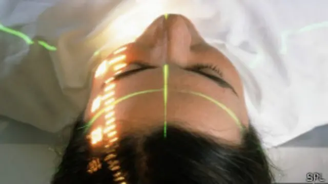 Escáner de unpaciente con tumor