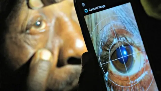 मोबाइल ऐप के जरिए मोतियाबिंद की जाँच