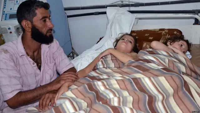 Presunto ataque químico en Siria