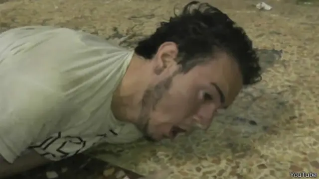 Пострадавший в "химической атаке"