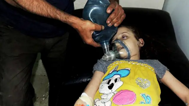 रासायनिक हमले में घायल एक बच्ची
