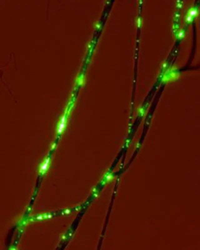 живий кістяк