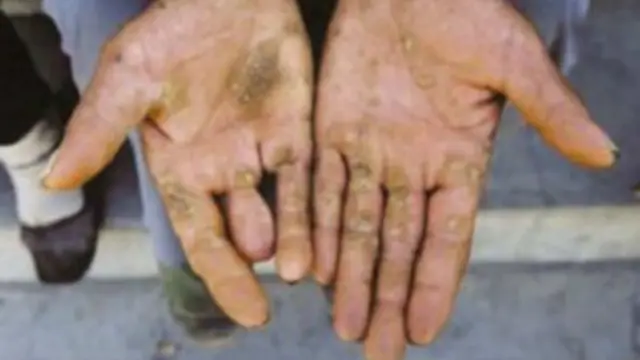 चीन आर्सेनिक प्रदूषण प्रभाव