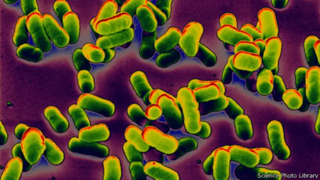 البكتريا المسببة لمرض الطاعون