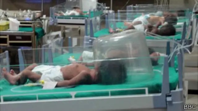 असमय जन्मे 10 बच्चों में से 1 कम शुगर स्तर से प्रभावित होता है