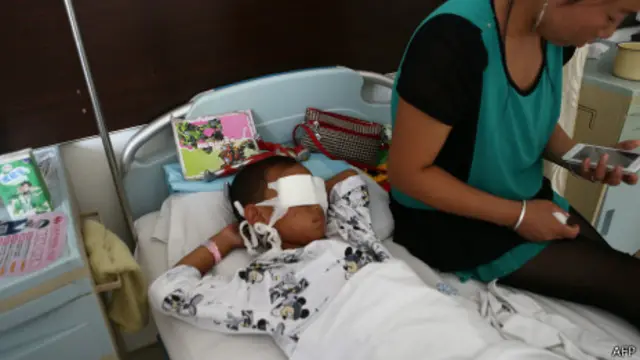 Мальчик, которому выкололи глаза