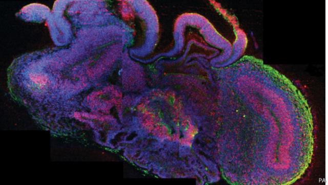 Minicérebro criado a partir de células-tronco (PA)