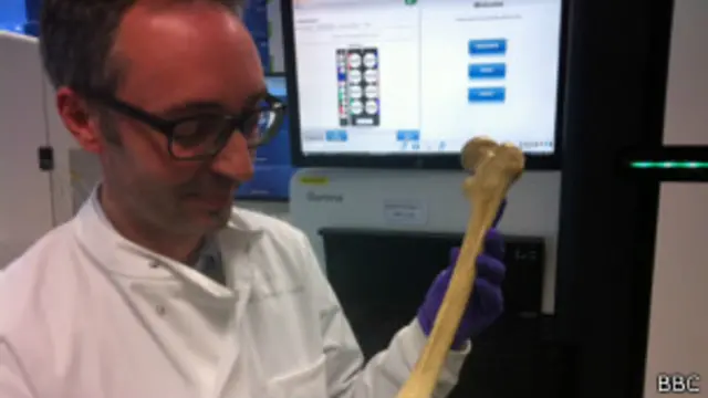 एलिफेंट मैन