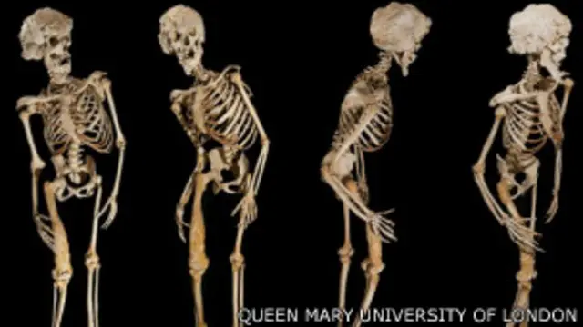 एलिफेंट मैन