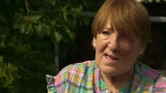 Ann O'Sullivan que passou por cirurgia de reconstrução da face com recurso de 3D | Foto: BBC