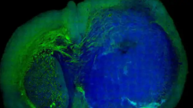 الجراحة الجديدة توفر الأمان المطلوب في عمليات الدماغ الدقيقة.