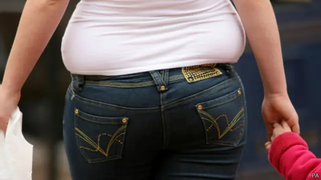 Obesidade | Foto: PA