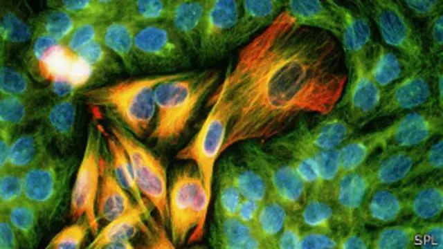 प्रोफ़ेसर जॉन वैगस्टाफ़ का मानना है कि परीक्षण के नतीजे काफी महत्वपूर्ण हैं.