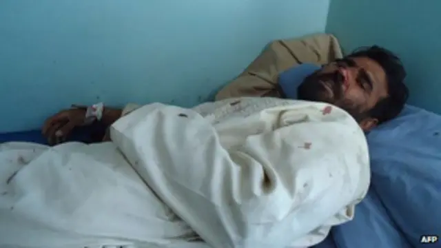 اصيب في هجوم غازني 17 شخصا