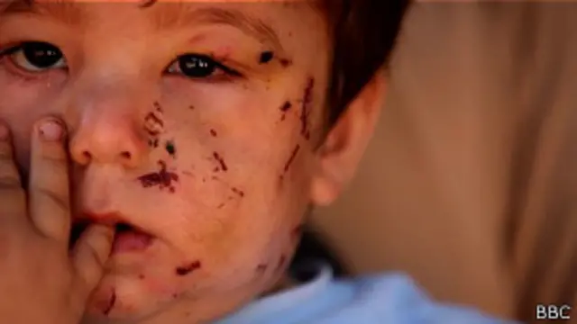 شام میں ڈھائی سال سے جاری کشیدگی کی وجہ سے اب تک ایک لاکھ سے زیادہ ہلاکتیں ہو چکی ہیں