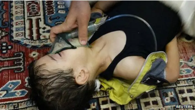 criança vítima de armas químicas | Reuters