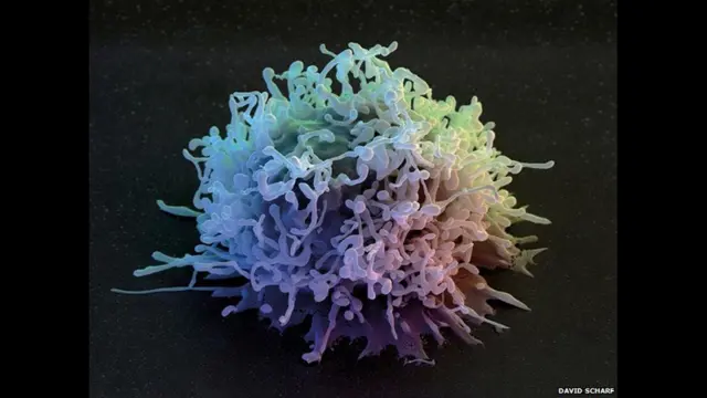 Foto: Human Lymphocyte, 2011, by David Scharf, Los Angeles