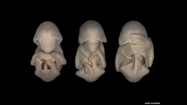 Foto: Bat embryonic development, 2006, by Dorit Hockman, University of Cambridge. Development of embryos of the Black Mastiff Bat