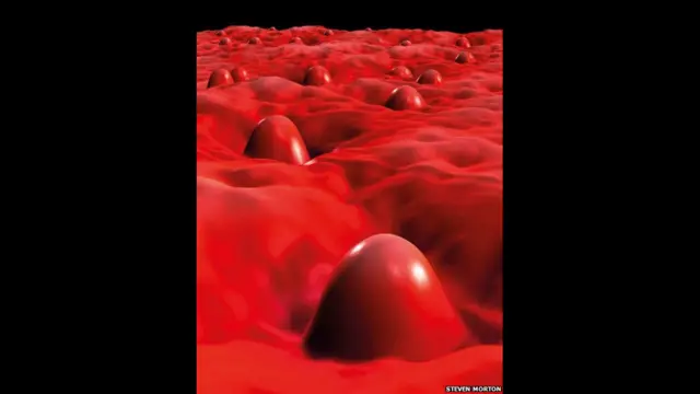 Foto: Malaria Infected Human Red Blood Cell, 2008, by Steven Morton, Monash University, Australia. 