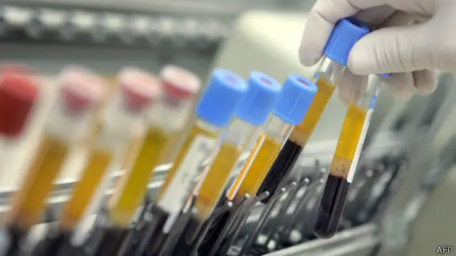 Việc lấy mẫu máu các trinh nữ bị chỉ trích là xúc phạm phụ nữ