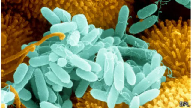 Infección bacteriana.