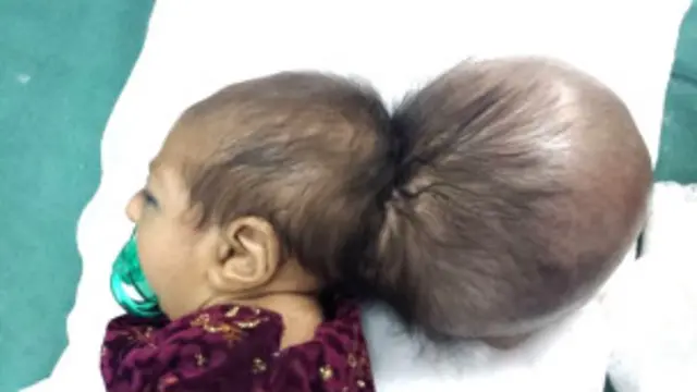 پزشکان می‌گویند این عمل جراحی سه ساعت طول کشید و بسیار پیچیده و دشوار بود