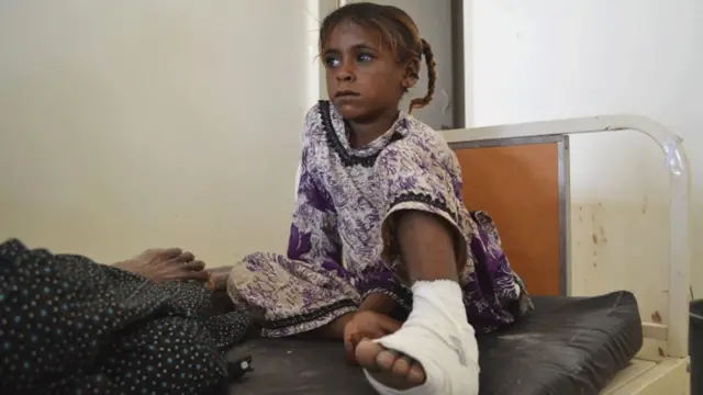 زخمی ہونے والے بچوں میں سے اکثر کی ہڈیاں ٹوٹی ہیں