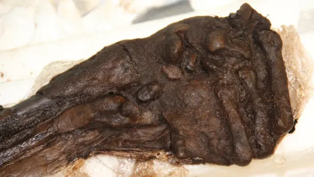 कैशेल मैन का हाथ, बीबीसी