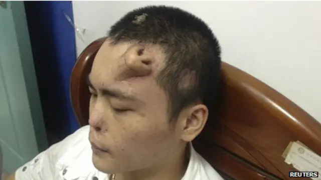 _hidung_didahi_xiaolian