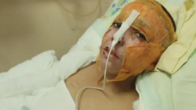 د کیمیاوي وسلو یوهّ ویجاړونکي برید سلګونه، ښايي تر زرو ډېر کسان ووژل