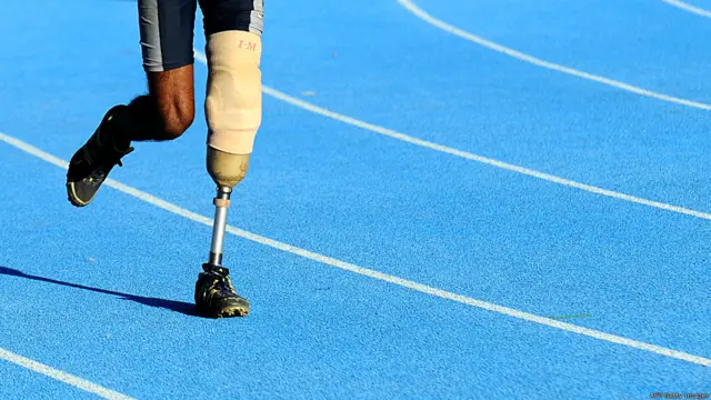 ඔවුන් බොහෝ දෙනෙකුට රජය මගින් කෘත්‍රිම අත් පා ලබා දී තිබේ.