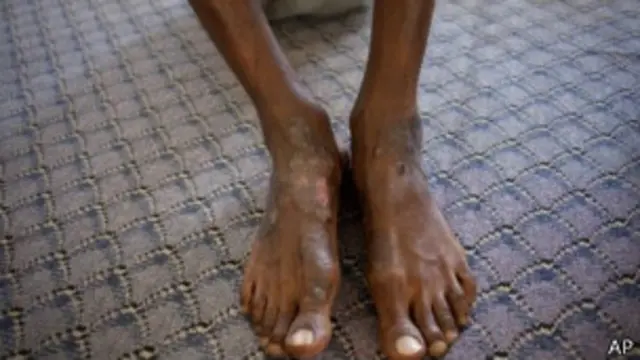 يقول التقرير إن التعذيب يشيع أكثر "عقب الاعتقال وخلال الأيام الأولى من الاستجواب."