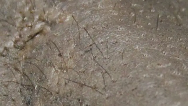 Pelos de la momia de Cashel