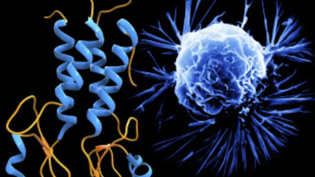 يمكن لسرطان العظام أن يصيب الشباب