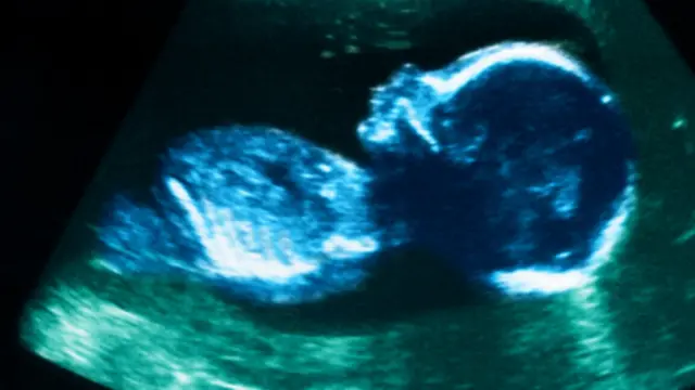 منتقدو المشروع يرون أنه سينطوي على مخاطر أخلاقية واجتماعية