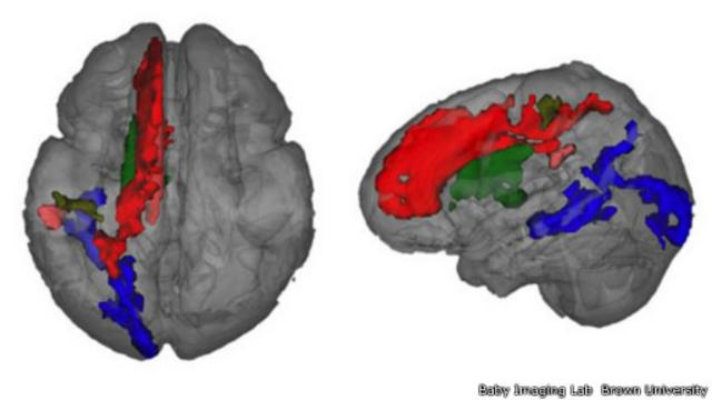 Scan mostra que o lado esquerdo do cérebro tem mais mielina
