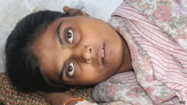 Reshma, vítima de violência doméstica na Índia