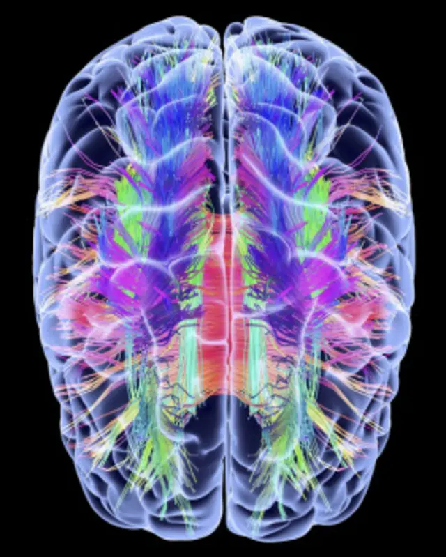 ह्यूमन ब्रेन प्रोजेक्ट