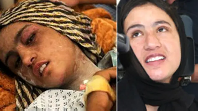 سحر ګل، هغه نجلۍ ده چې په کم عمر کې واده شوې وه.