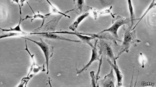 Células cerebrais (fto: Getty Images)