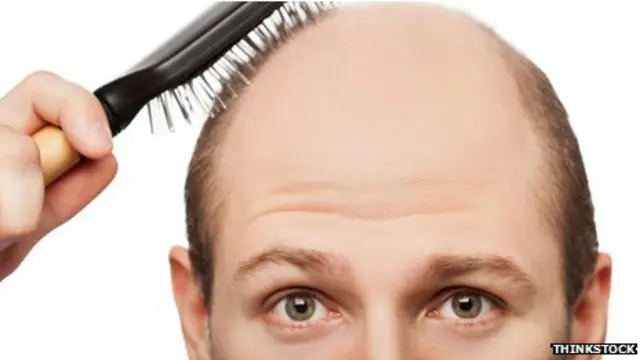 Лысый мужчина