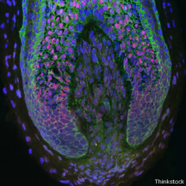 Изображение волосяной луковицы